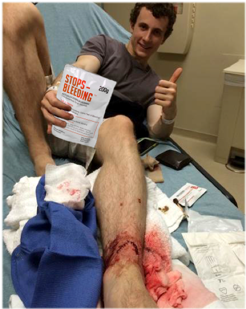 Man with cut on ankle holding StopsBleeding™ pouch